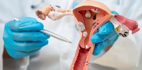 Médicos moçambicanos removem mioma uterino de 10,5 quilogramas