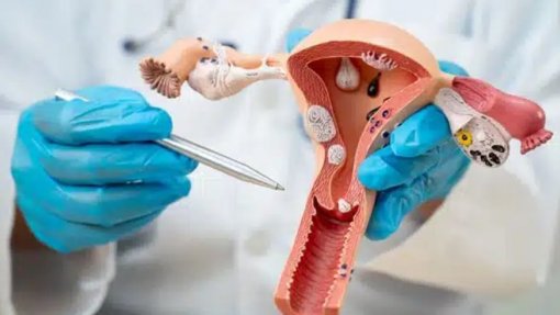 Médicos moçambicanos removem mioma uterino de 10,5 quilogramas