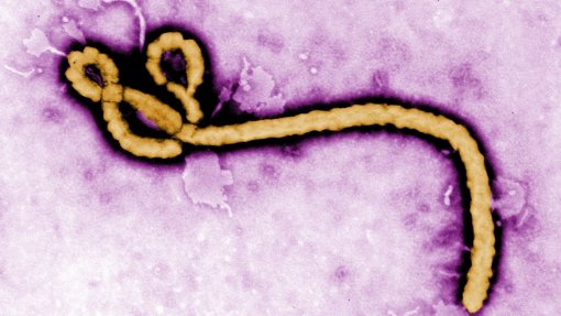 Ébola: União Africana critica restrições dos EUA à entrada no país