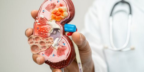 VILA NOVA DE GAIA: Estudo de prevalência da doença renal crónica
