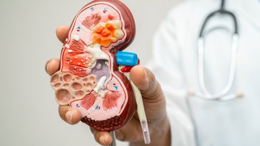 VILA NOVA DE GAIA: Estudo de prevalência da doença renal crónica