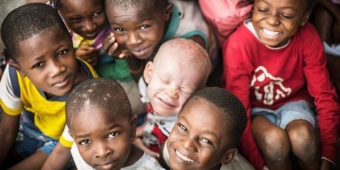 Albinos no Maláui enfrentam discriminação e obstáculos devido a mitos - Organizações