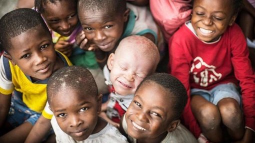 Albinos no Maláui enfrentam discriminação e obstáculos devido a mitos - Organizações