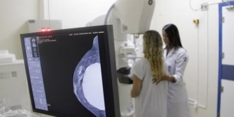 Novo mamógrafo da Terceira em funcionamento nas “próximas duas semanas” - Governo Regional