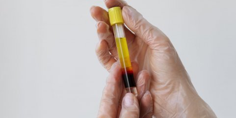 Governo atribui quatro milhões a aproveitamento de plasma para medicamentos