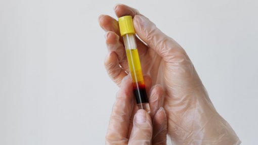 Governo atribui quatro milhões a aproveitamento de plasma para medicamentos