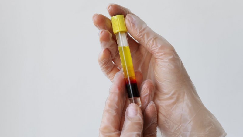 Governo atribui quatro milhões a aproveitamento de plasma para medicamentos