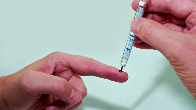 Informação dispersa e pouco articulada dificulta monitorização do VIH em Portugal - peritos