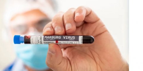 Um caso de vírus de Marburg confimado esta semana no Uganda - OMS