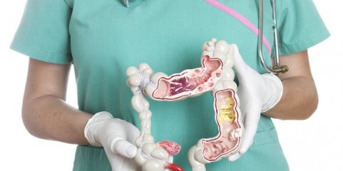 Abordagem preventiva da doença de Crohn em ensaio clínico – i3S