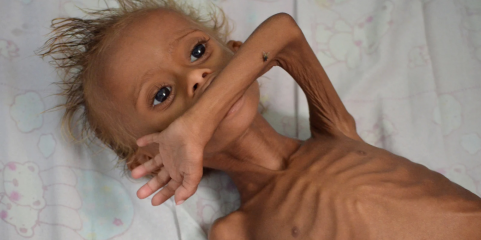 Afeganistão: 3,7 milhões de menores de 05 anos em risco de desnutrição – ONU