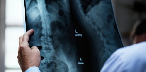 SNS gastou em 2025 mais de 135 milhões de euros com radiologia no setor convencionado