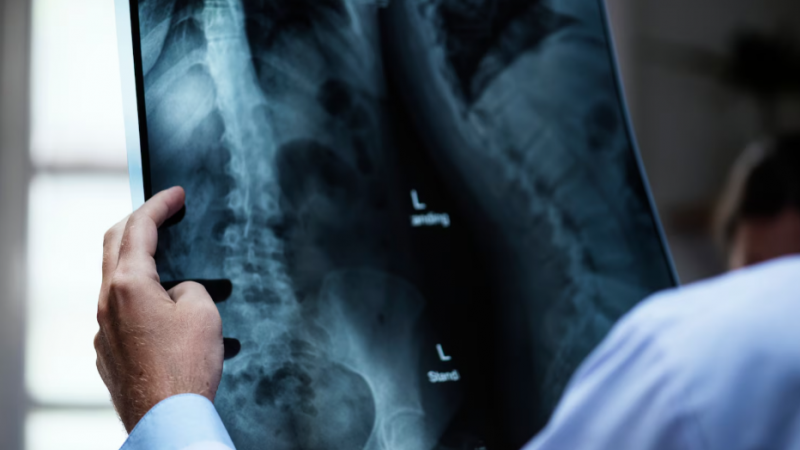 SNS gastou em 2025 mais de 135 milhões de euros com radiologia no setor convencionado