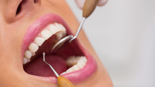Nova carreira de médicos dentistas permitirá contratação estável - Sindicato