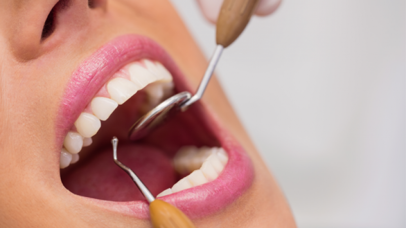 Nova carreira de médicos dentistas permitirá contratação estável - Sindicato