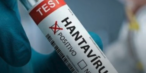 França deteta novo caso de hantavírus transmissível entre humanos