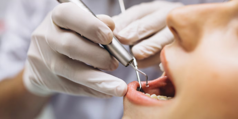 Publicada carreira especial de médico dentista no SNS