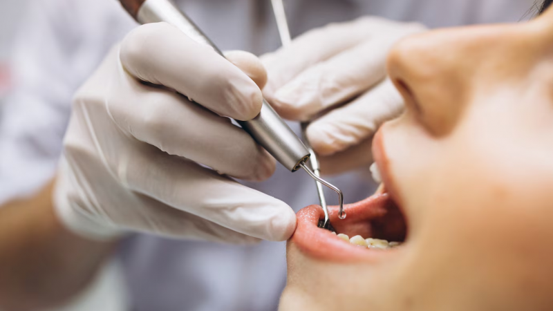 Publicada carreira especial de médico dentista no SNS