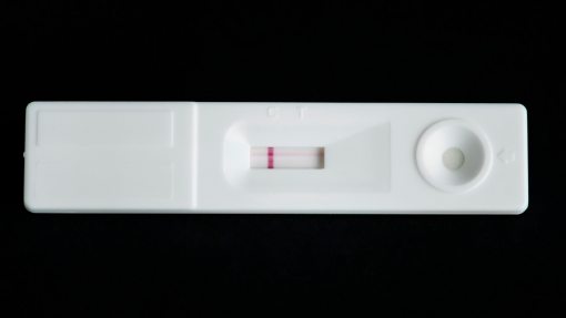 Ébola: Bruxelas envia testes de diagnóstico de 2,5 ME para conter epidemia na RDCongo