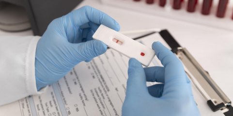 Ébola: Comissão Europeia mobiliza 2,1 ME em testes para combater epidemia na RDCongo