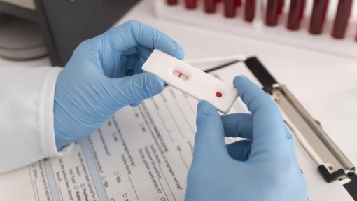 Ébola: Comissão Europeia mobiliza 2,1 ME em testes para combater epidemia na RDCongo