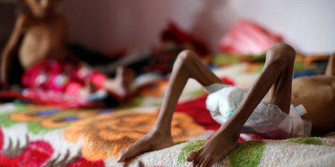 Afeganistão: Um milhão de crianças em risco de morrer por subnutrição - ONU