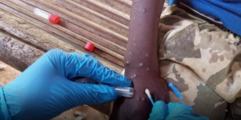 Mpox: Angola é segundo país africano com mais casos recentes da doença - OMS