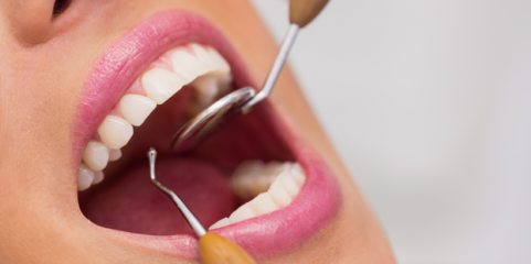 Projeto financiou tratamentos dentários a 10 doentes com cancro no Alto Tâmega