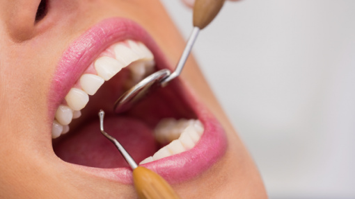 Projeto financiou tratamentos dentários a 10 doentes com cancro no Alto Tâmega