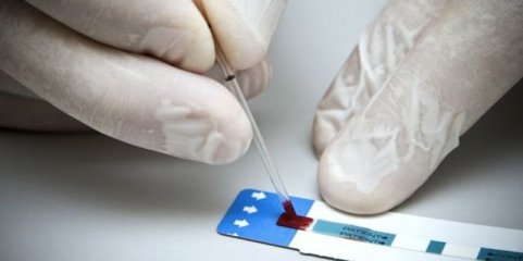 ULS e farmácias definem referenciação para cuidados de saúde após rastreios