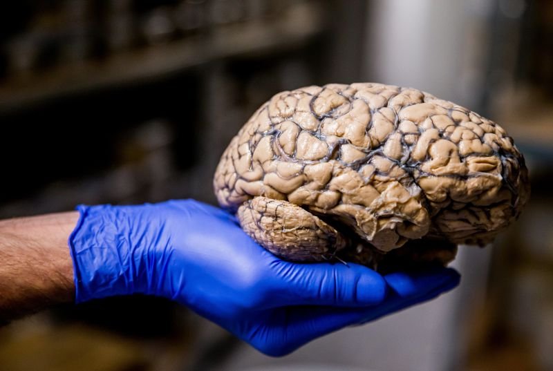 Des scientifiques de Coimbra aident à démêler le mécanisme de développement du cerveau