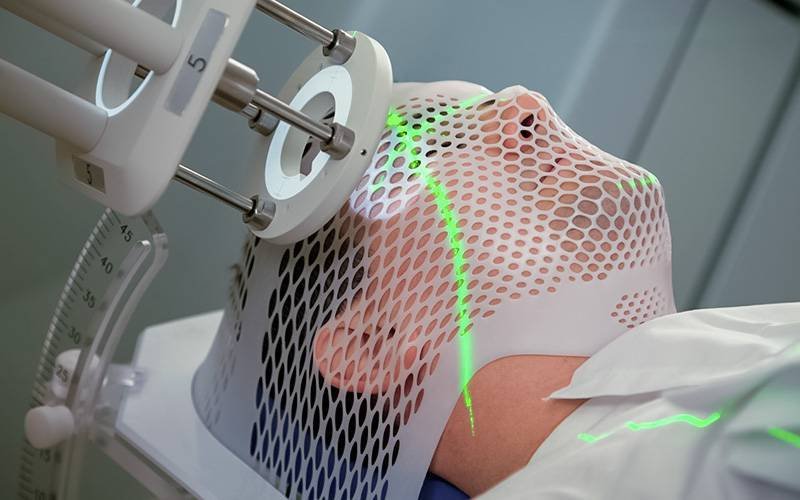 Cientistas identificam medicamento que pode reverter resistência à radioterapia cerebral