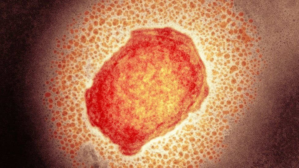 Portugal with 633 confirmed cases of monkeypox virus