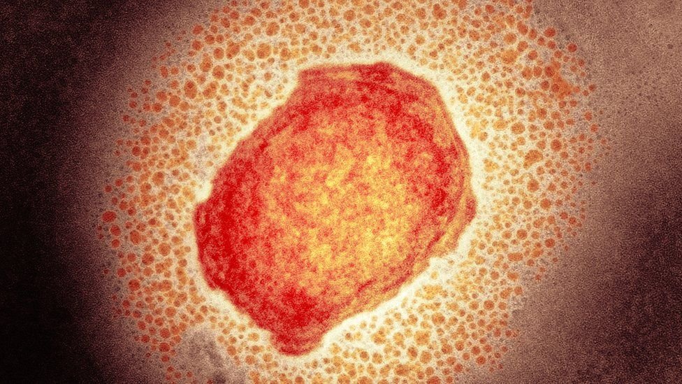 Portugal avec 633 cas confirmés d’infection par le virus Monkeypox