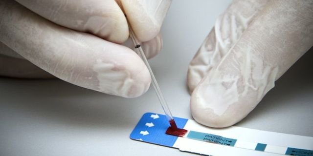 Loures-Odivelas Health Unit and Pharmacies Agree Referral Route After HIV and Hepatitis Screening